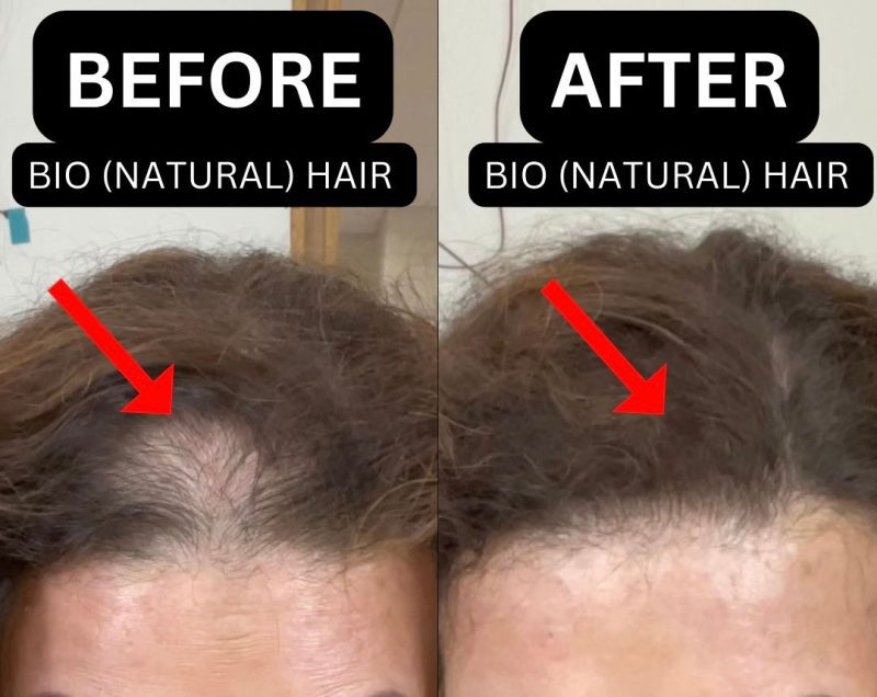 DebBioHairBeforeandAfter