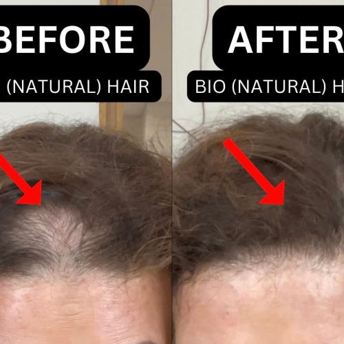 DebBioHairBeforeandAfter e8d7a1af eb33 4d49 9427 ab17e96b784d